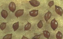 Hububat kist nematodu ergin dişileri.